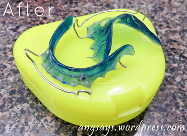 Clean Retainers Clean Retainer