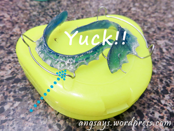 removing white retainer buildup